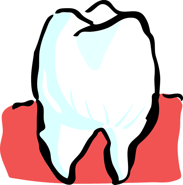 Wisdom teeth frequently grow irregularly